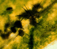 Acervuli w/ Dark Spines