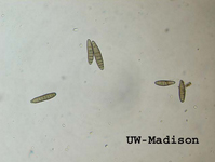 Cigar Shaped Conidia