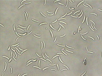 Crescent Shaped Conidia