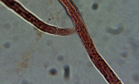 Hyphae Crosswalls and 90° Branching