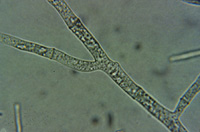 Hyphae Crosswalls and Y-Branching