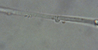 Hyphae w/ Clamp Connections